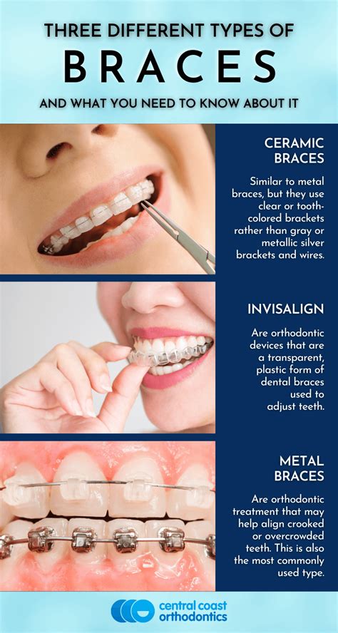 pictures of braces|types of braces pictures.